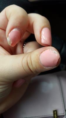 Poorly done gel manicure that has ruined my nails