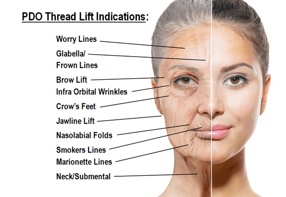 Non-surgical facelift to reduce wrinkles and tighten lose skin.