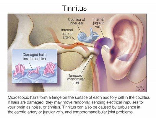 We offer tinnitus therapy!