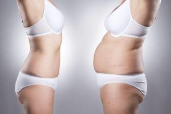 Loose  weight with I-lipo laser treatments.