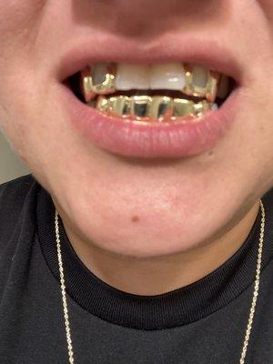 KL Grillz and Jewelry