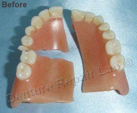 Denture repair lab