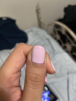 You can see the exposed skin on the lower right side of my nail