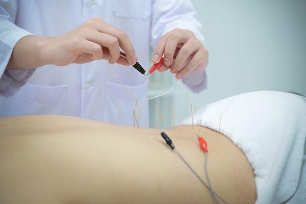 Electro-Acupuncture