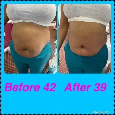 Fat Reduction!!!!