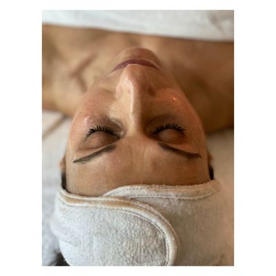 Client immediately after Environ Vitamin Infusion Facial