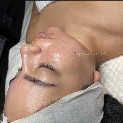 Hydro facial deluxe