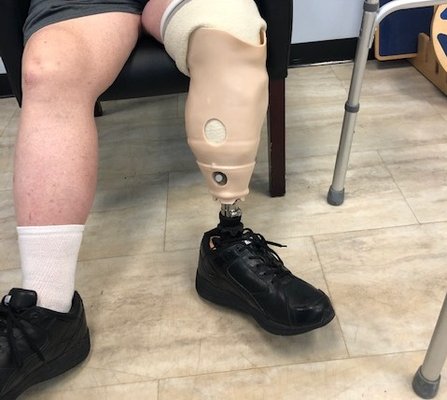 Prosthetic Training