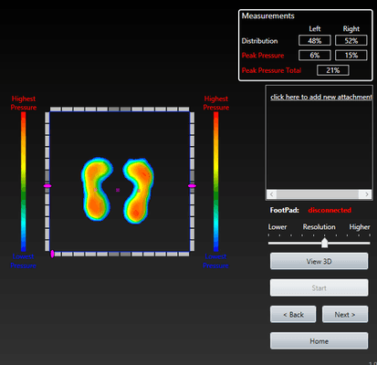 How do you place the loads on your feet? We can measure where you put the loads while you are standing.