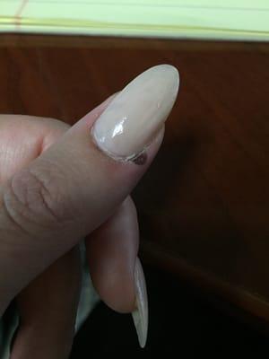 Third visit to this salon: blood blister still present several days after nail application.