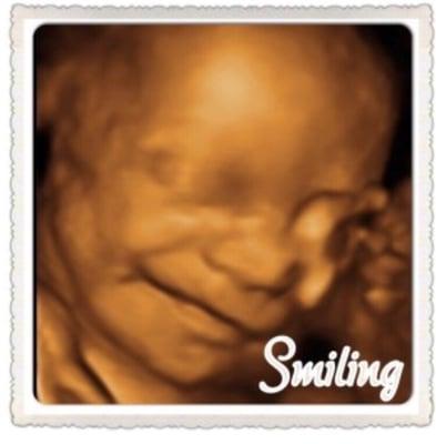 Smiling in 3D ultrasound.