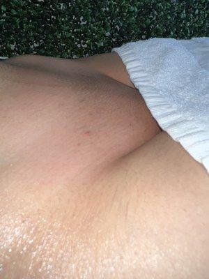 Full brazilian wax