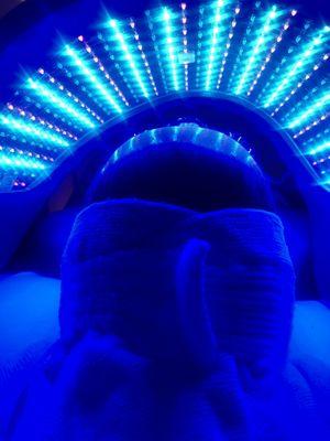 LED light therapy for acne