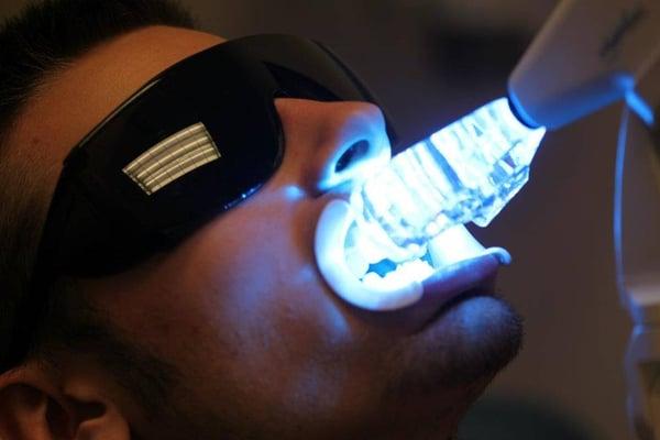 Milwaukee Teeth Whitening!