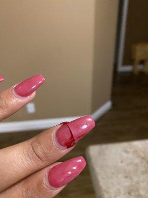 Broken nail