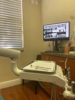 Nice big screen monitor to show you your teeth and work being performed. Takes X-rays before, mid and at end!