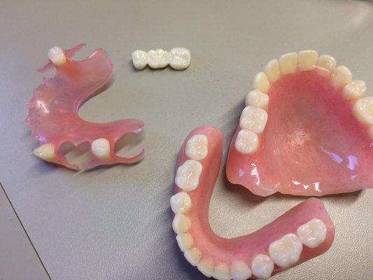 VALPLAST, ZERCONA, and FULL DENTURE