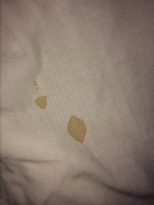 Bloodstain found on sheet.