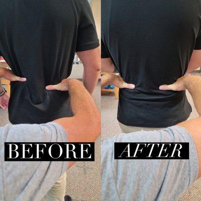 Having back pain? Chances are you are out of align. Unlike chiropractors, we use a non-cracking approach to align your spine for good.