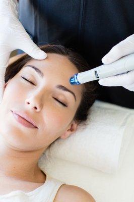 Hydrafacial treatment