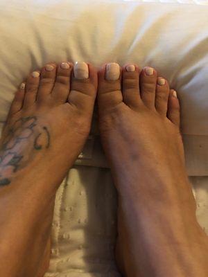 Post pedicure- day 2.