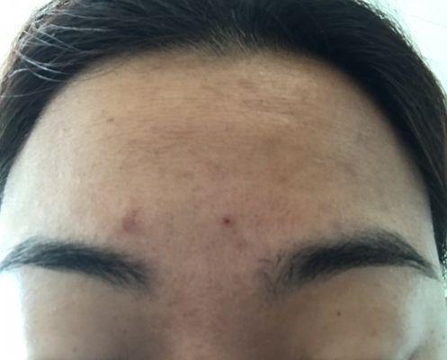 Eyebrow threading