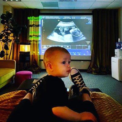 Ultra Baby 3D 4D 5D Ultrasound Studio