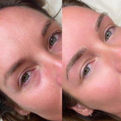 COMBINATION BROW TECHNIQUE