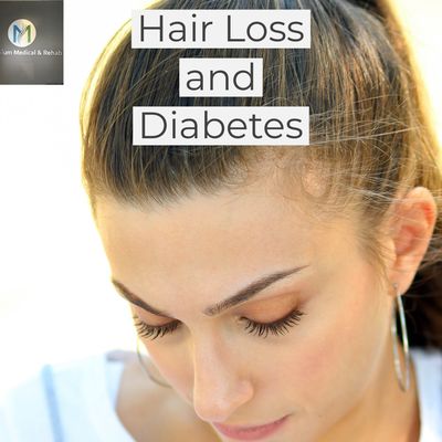 Diabetes can affect hair loss