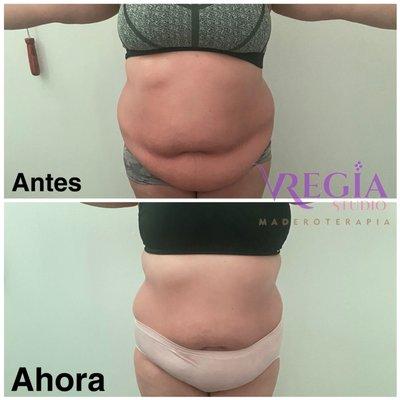 Maderoterpia corporal
Yesoterapia 
Body wraps 
Reduce talla
Moldea y tonifica 
Levantamiento de glúteos 
Resultados desde la primera sección