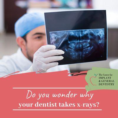 X-rays can allow dentists to see bone loss, look for decay between teeth and under fillings, look for infection or examine procedural areas.