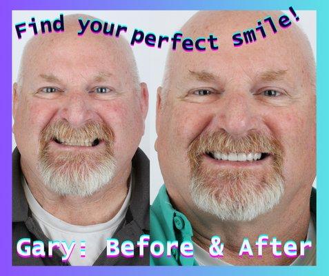 Whiteridge Aesthetic Dentistry: Find your perfect smile! whiteridgedental.com 801-942-7770