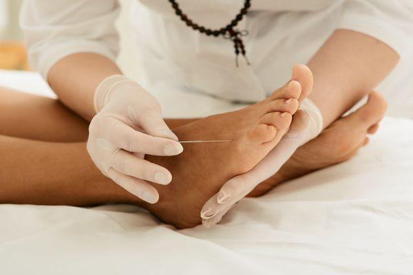 Medical Acupuncture