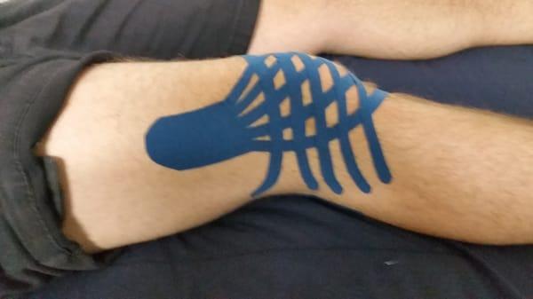 Kinesio Taping used to reduce knee swelling