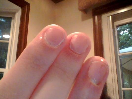 The immediate aftermath of my manicure here. I had to take all the polish off because it stung so badly.