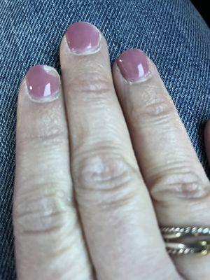 Chipped powder gel nails and ragged cuticles.