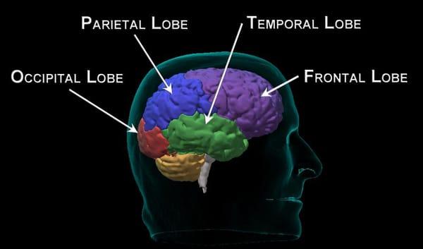 Here is another view showing the basic layout of the lobes in this persons brain.