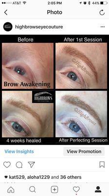 Brow Awakening evolution