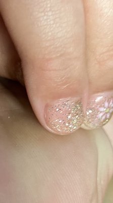 This is my daughters nail with half the nail missing when my wife said something again she had no time .