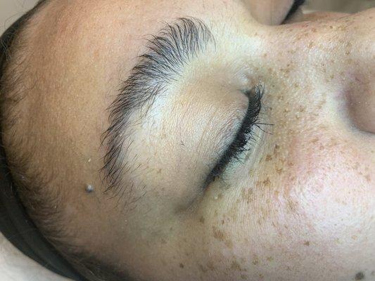 Eyebrow Before