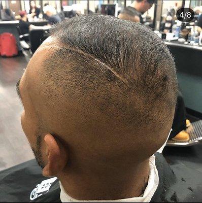 High skin fade