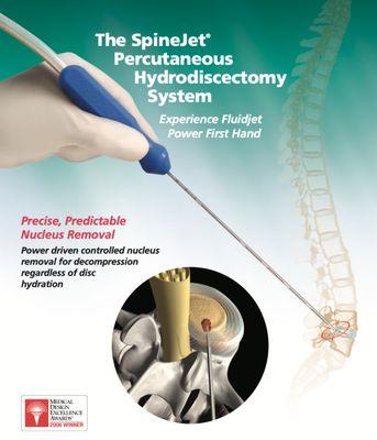 SpineJet uses a high-speed water stream to remove herniated disc tissue, thereby relieving the nerve pressure that causes back and leg pain.