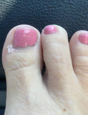 Terrible pedicure