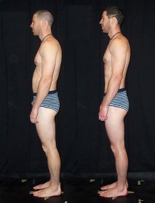 Rolfing in Austin- before and after 10 series- www.certifiedrolferaustin.com