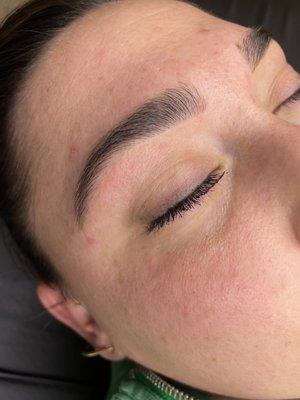 Brow clean up