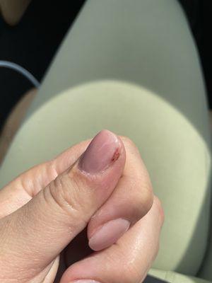 Ripped the side of my nail down the nail bed!!