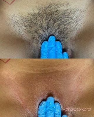 Brazilian Wax