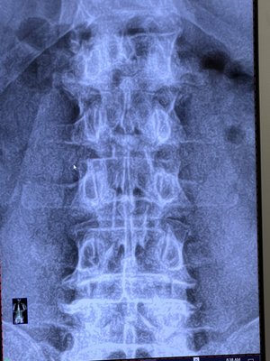 Digital x-rays performed on site