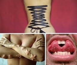 Corset, sub dermal implants, tongue splitting