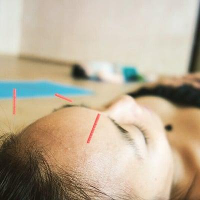 Emily Grace Acupuncture